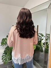 Pink Striped Lace Hem Top Adelaide